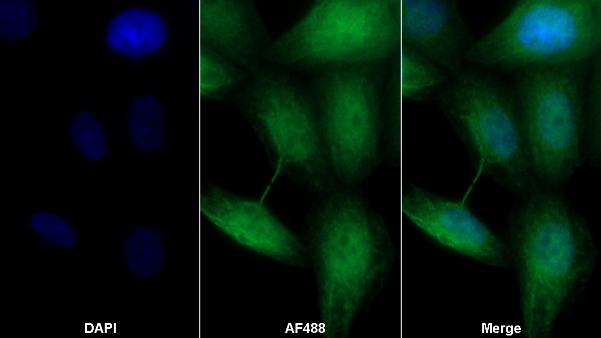 Monoclonal Antibody to Matrix Metalloproteinase 13 (MMP13)