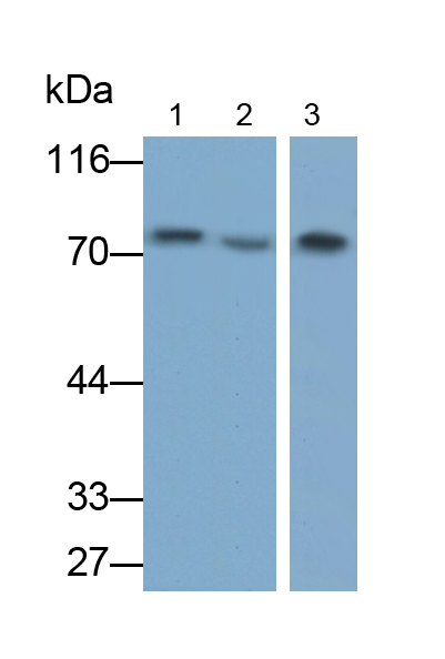 Monoclonal Antibody to Matrix Metalloproteinase 2 (MMP2)