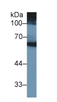 Monoclonal Antibody to Matrix Metalloproteinase 3 (MMP3)