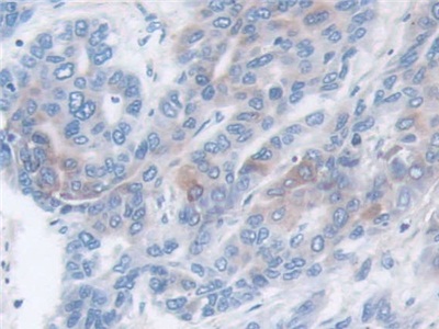 Monoclonal Antibody to Matrix Metalloproteinase 3 (MMP3)