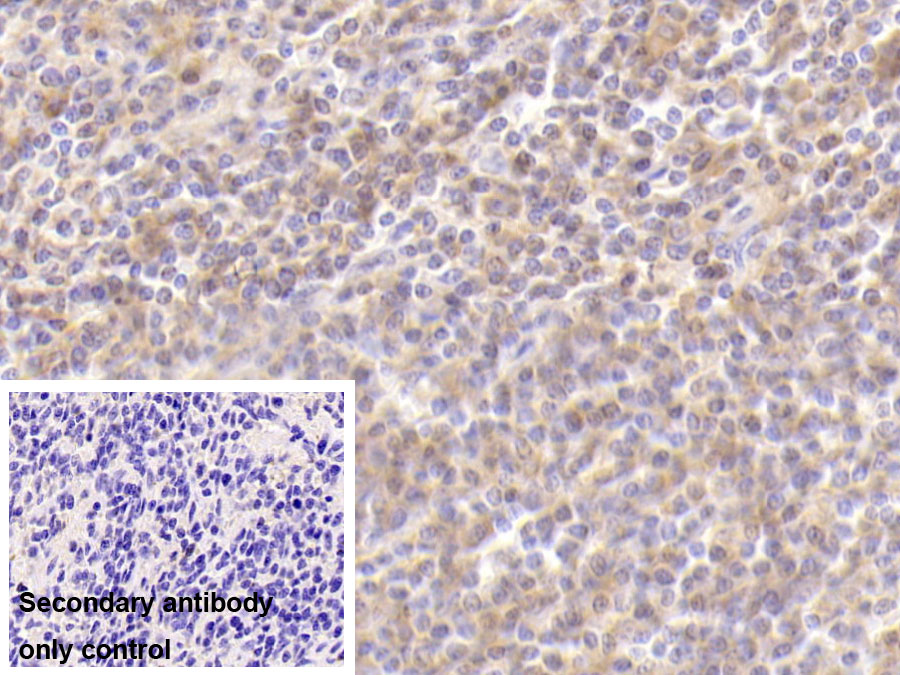 Monoclonal Antibody to Matrix Metalloproteinase 7 (MMP7)