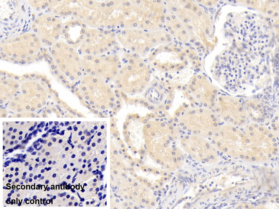 Monoclonal Antibody to Matrix Metalloproteinase 7 (MMP7)