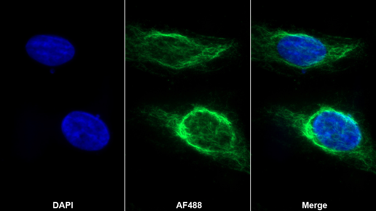 Monoclonal Antibody to Matrix Metalloproteinase 8 (MMP8)