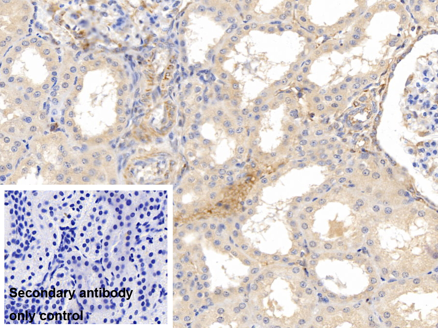 Monoclonal Antibody to Matrix Metalloproteinase 8 (MMP8)
