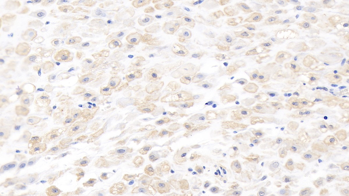 Monoclonal Antibody to Matrix Metalloproteinase 8 (MMP8)