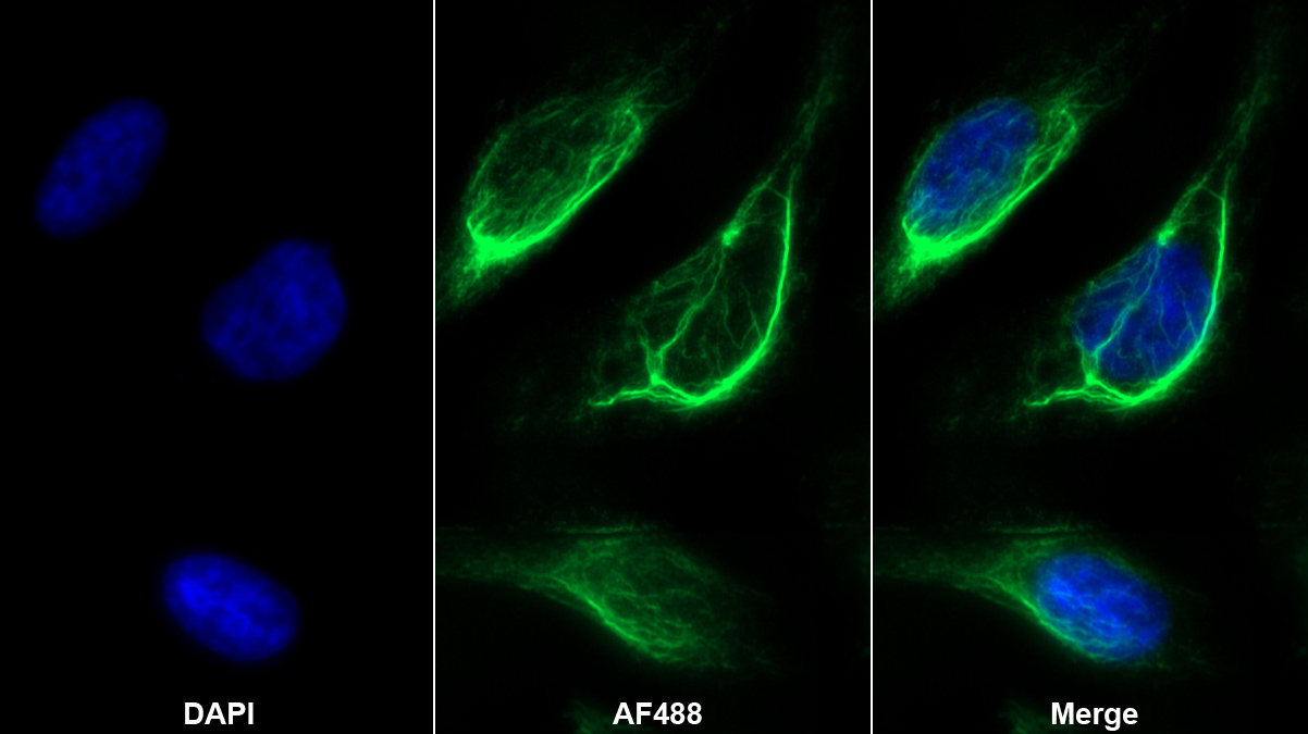 Monoclonal Antibody to Matrix Metalloproteinase 8 (MMP8)