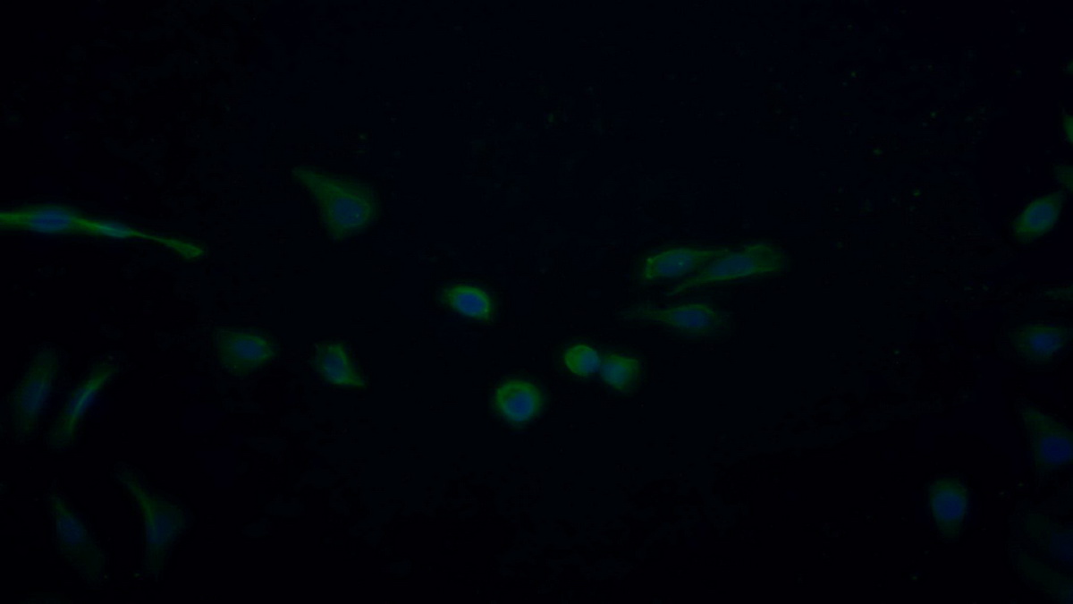 Monoclonal Antibody to Nerve Growth Factor (NGF)