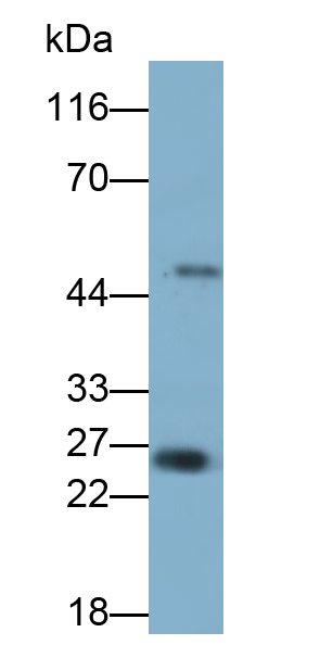 Monoclonal Antibody to Nerve Growth Factor (NGF)
