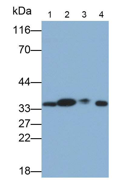 Monoclonal Antibody to Nerve Growth Factor (NGF)