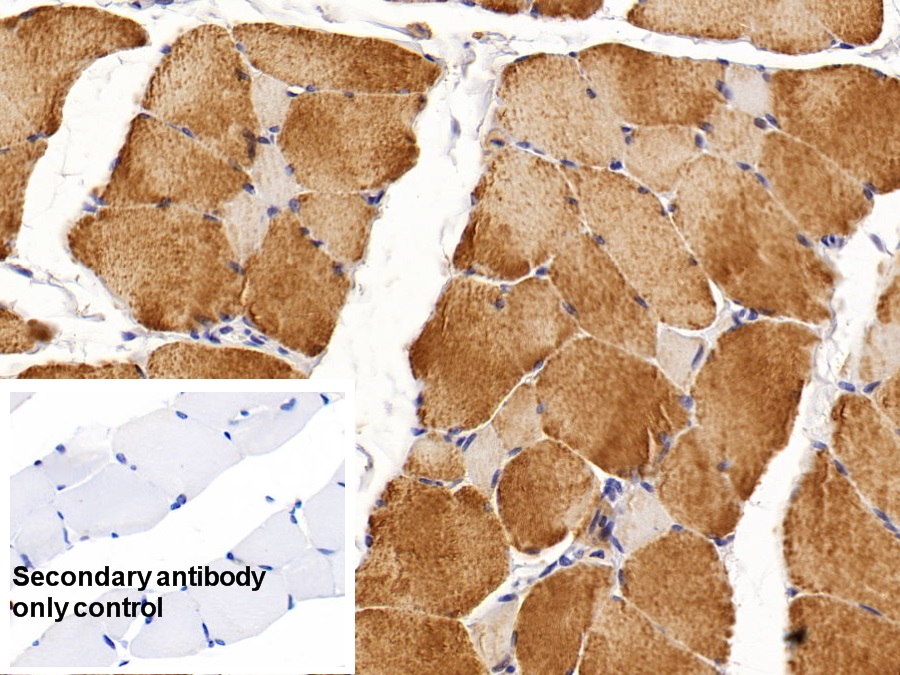 Monoclonal Antibody to Creatine Kinase, Muscle (CKM)