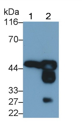 Monoclonal Antibody to Creatine Kinase, Muscle (CKM)