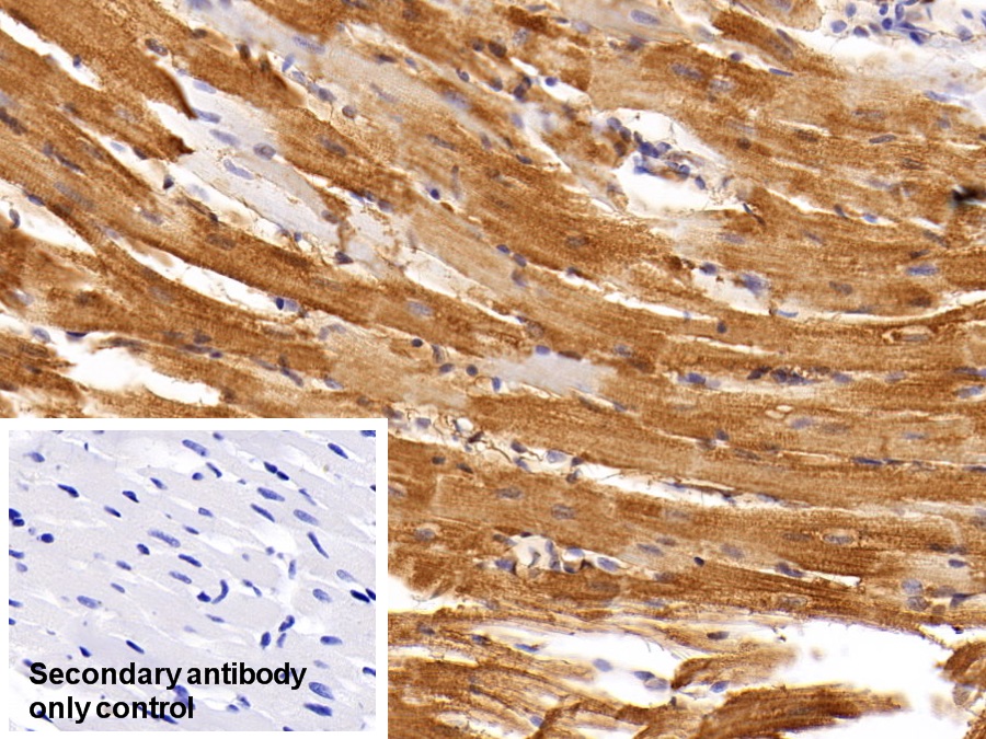 Monoclonal Antibody to Creatine Kinase, Muscle (CKM)