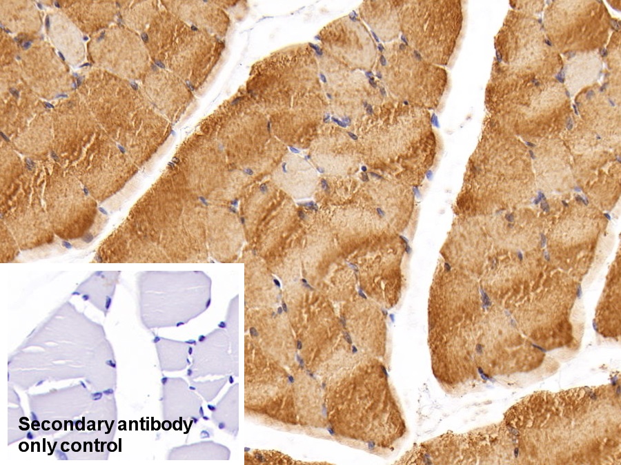 Monoclonal Antibody to Creatine Kinase, Muscle (CKM)