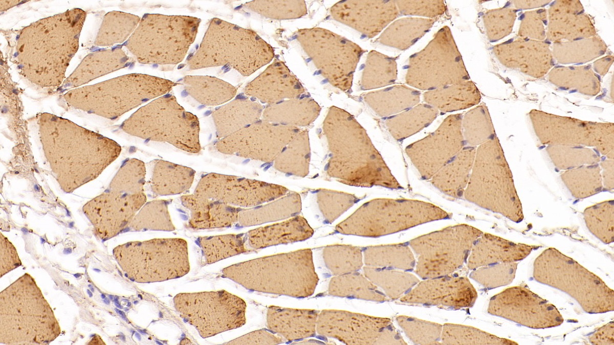 Monoclonal Antibody to Creatine Kinase, Muscle (CKM)