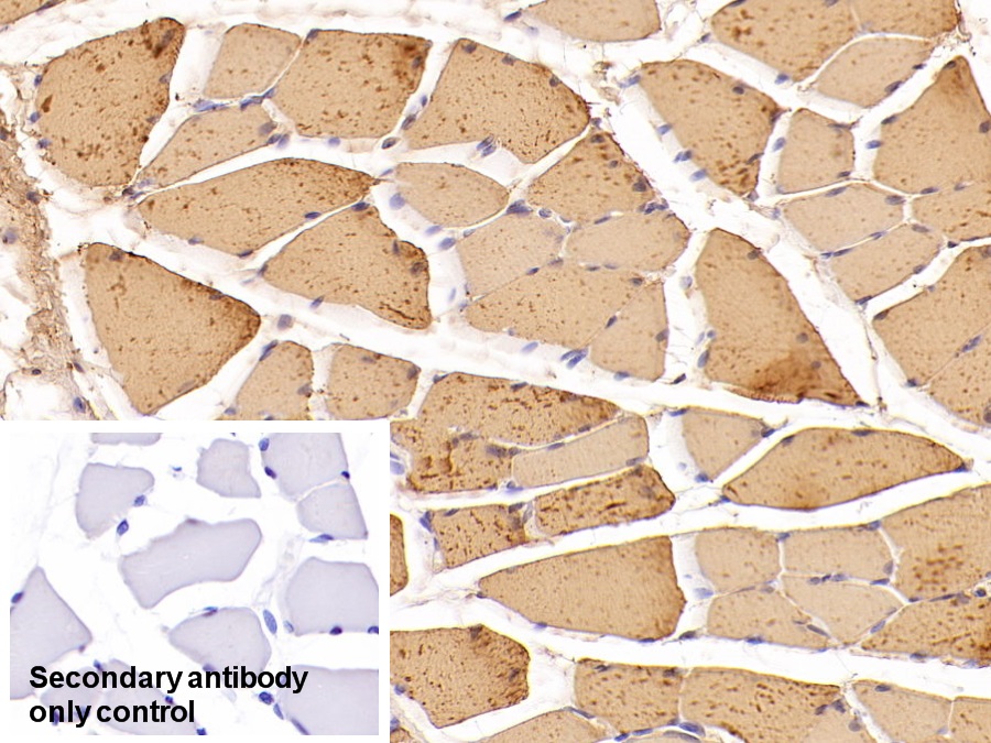 Monoclonal Antibody to Creatine Kinase, Muscle (CKM)