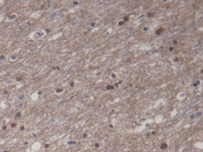 Monoclonal Antibody to Creatine Kinase, Muscle (CKM)