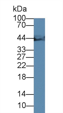 Monoclonal Antibody to Creatine Kinase, Muscle (CKM)