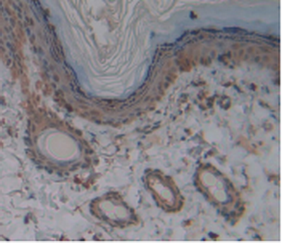 Monoclonal Antibody to Stem Cell Factor Receptor (SCFR)