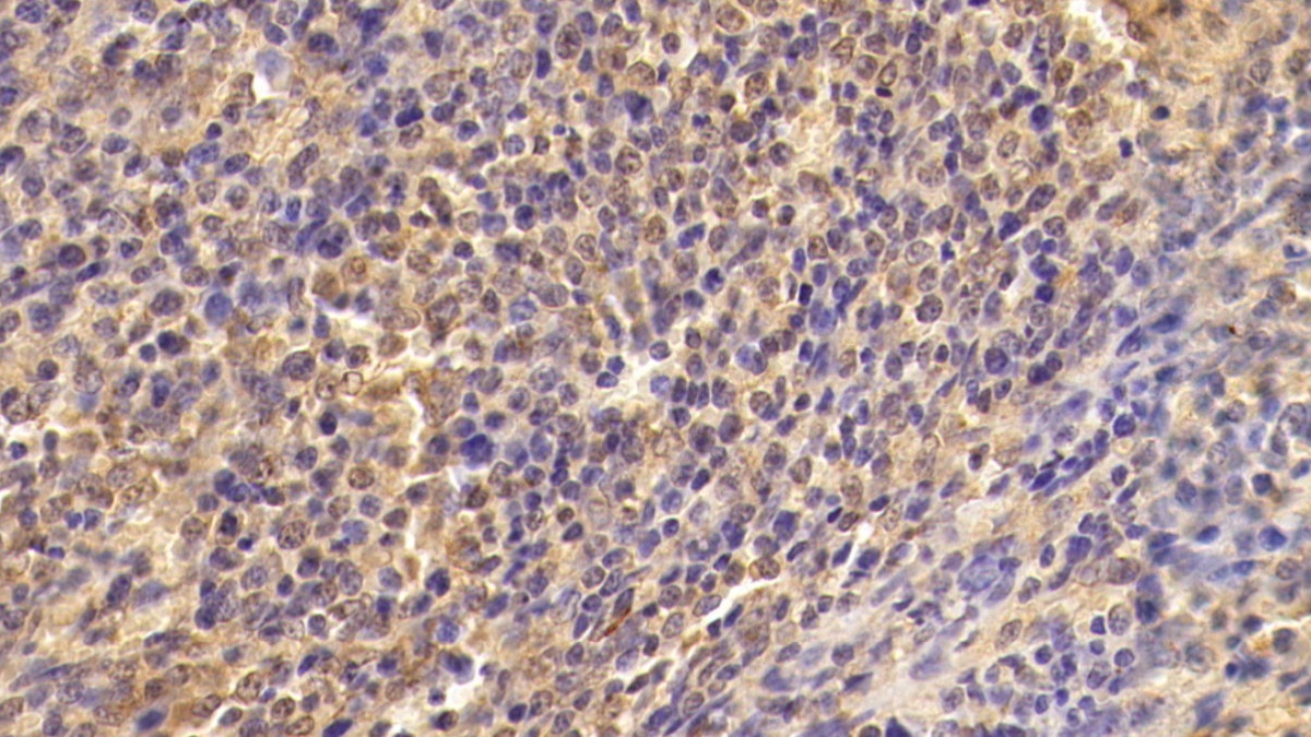 Monoclonal Antibody to Transforming Growth Factor Beta 1 (TGFb1)