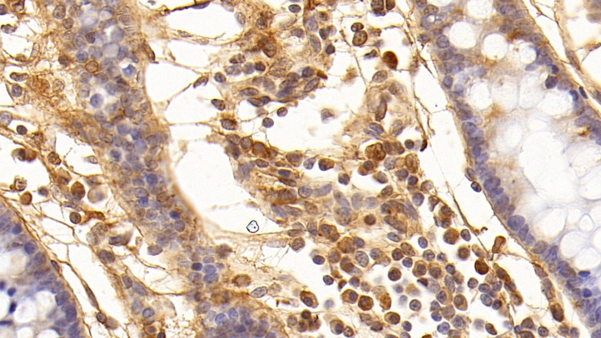 Monoclonal Antibody to Transforming Growth Factor Beta 1 (TGFb1)