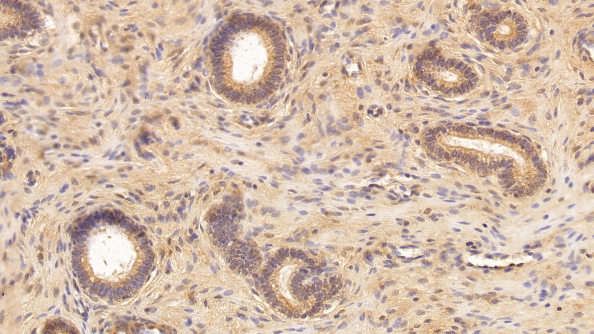 Monoclonal Antibody to Transforming Growth Factor Beta 1 (TGFb1)