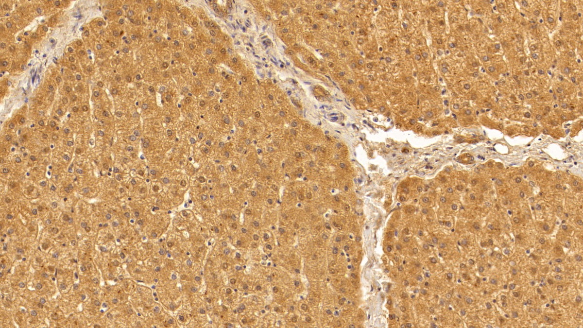 Monoclonal Antibody to Transforming Growth Factor Beta 1 (TGFb1)