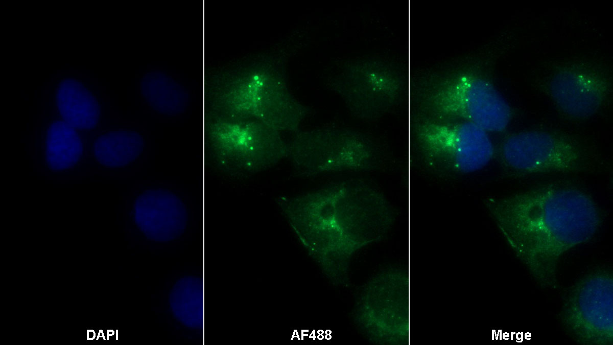 Monoclonal Antibody to Transforming Growth Factor Beta 1 (TGFb1)