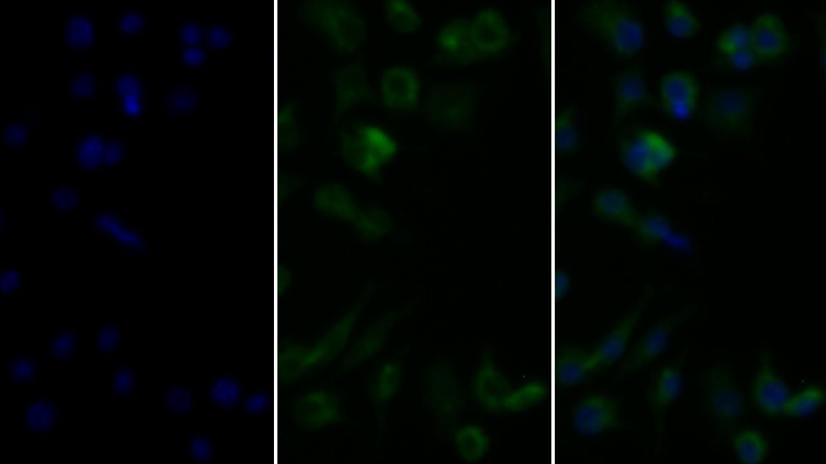 Monoclonal Antibody to Tumor Necrosis Factor Alpha (TNFa)