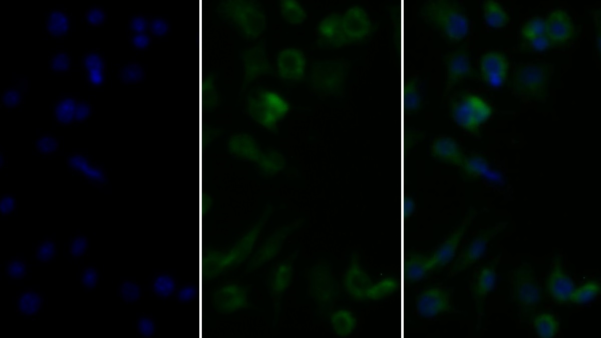 Monoclonal Antibody to Tumor Necrosis Factor Alpha (TNFa)