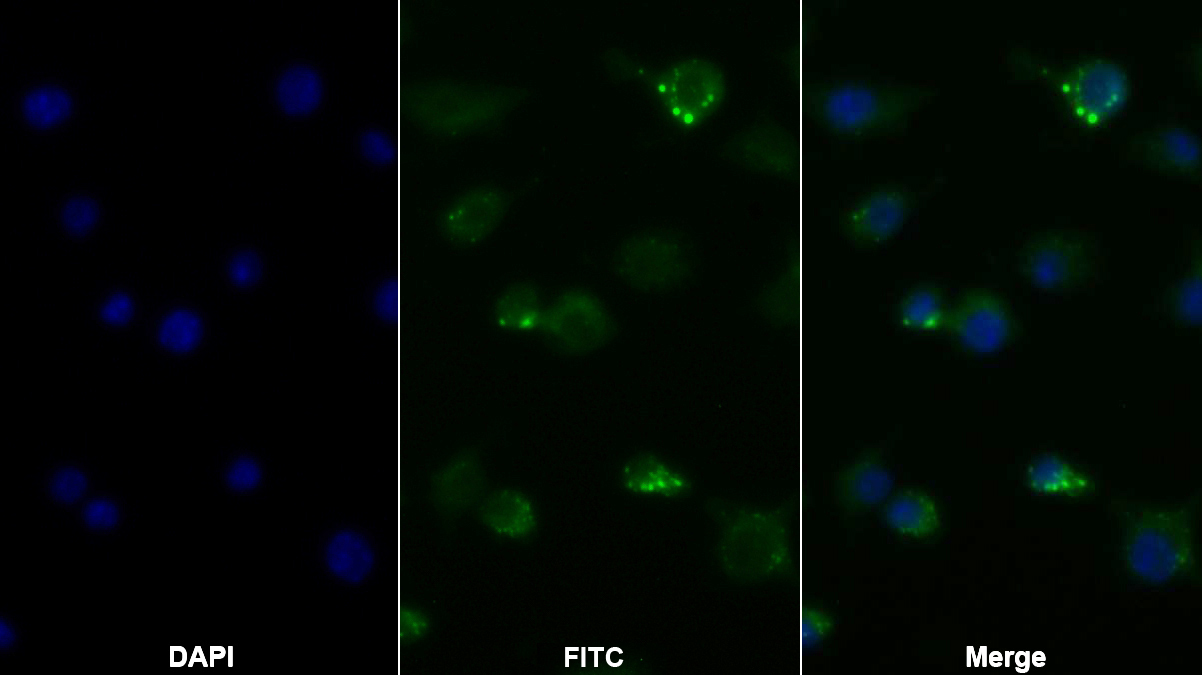 Monoclonal Antibody to Tumor Necrosis Factor Alpha (TNFa)