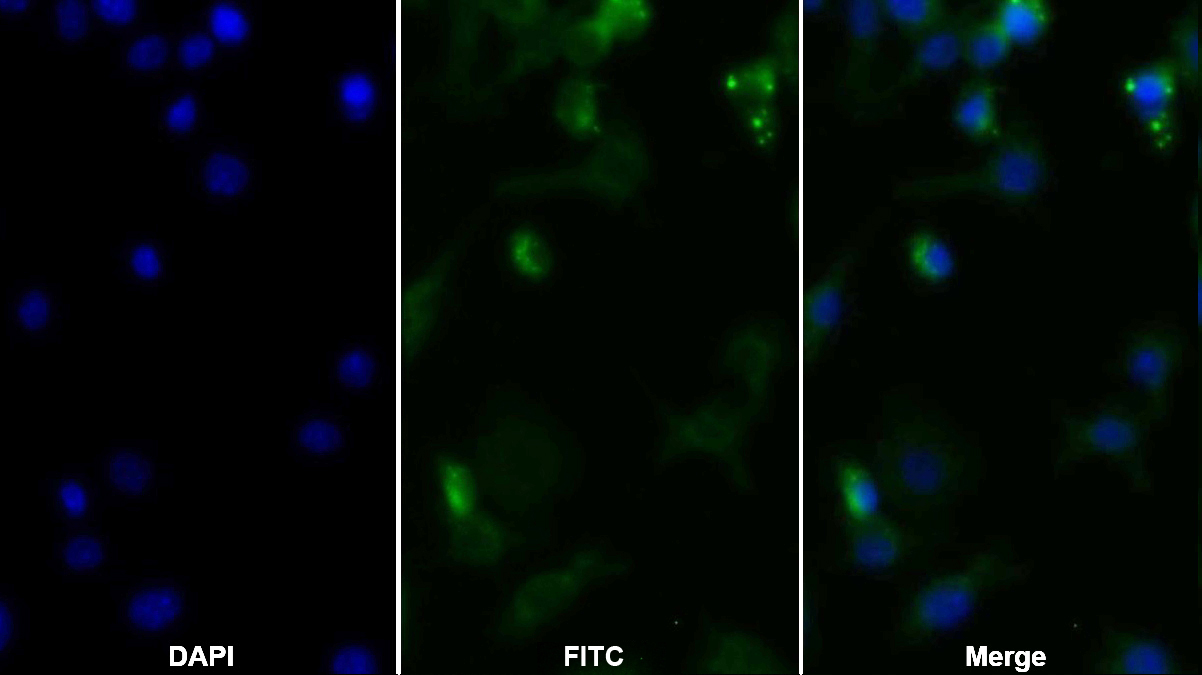 Monoclonal Antibody to Tumor Necrosis Factor Alpha (TNFa)