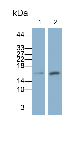 Monoclonal Antibody to Tumor Necrosis Factor Alpha (TNFa)