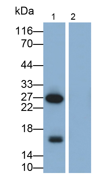 Monoclonal Antibody to Tumor Necrosis Factor Alpha (TNFa)