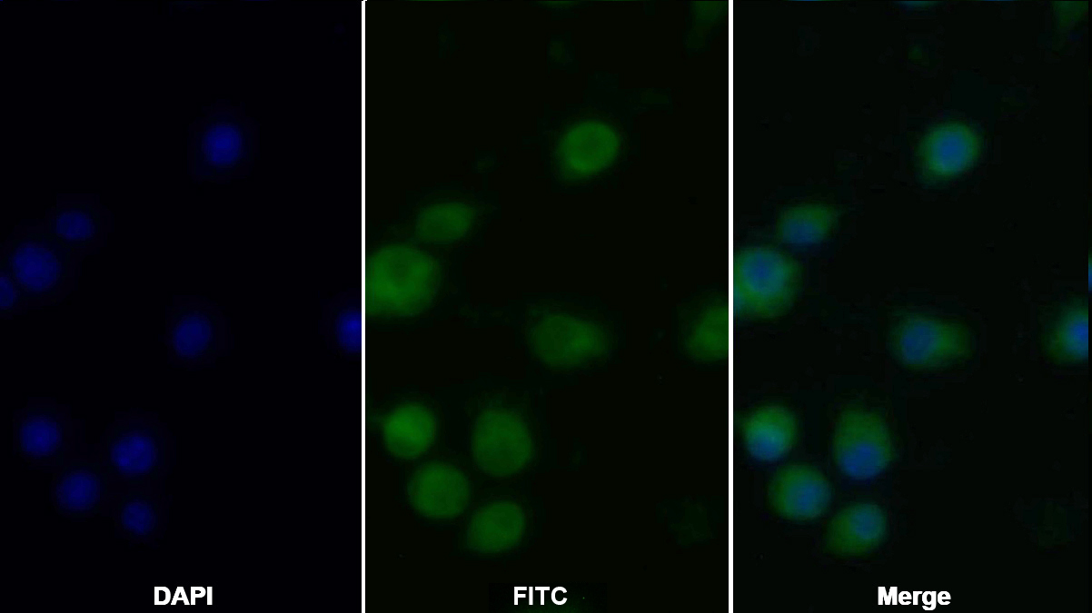 Monoclonal Antibody to Tumor Necrosis Factor Alpha (TNFa)