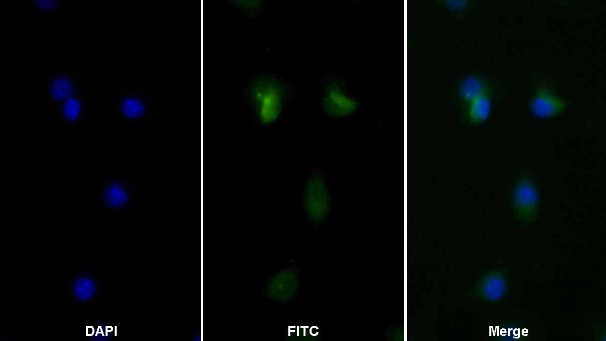 Monoclonal Antibody to Tumor Necrosis Factor Alpha (TNFa)