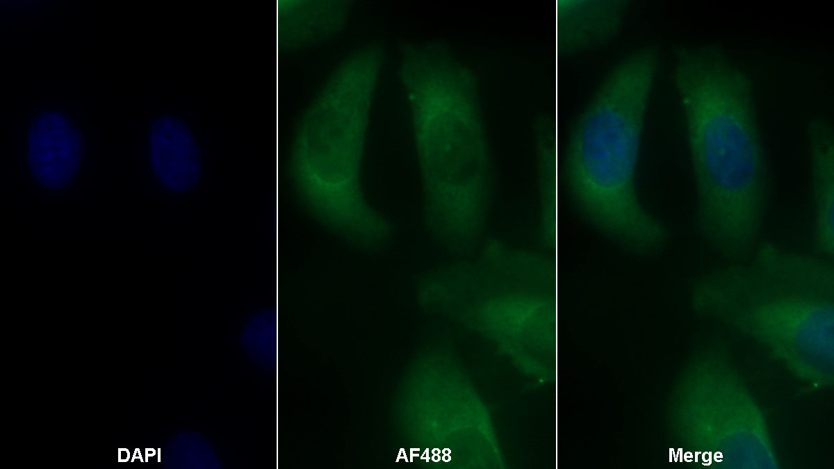 Monoclonal Antibody to Vascular Endothelial Growth Factor A (VEGFA)