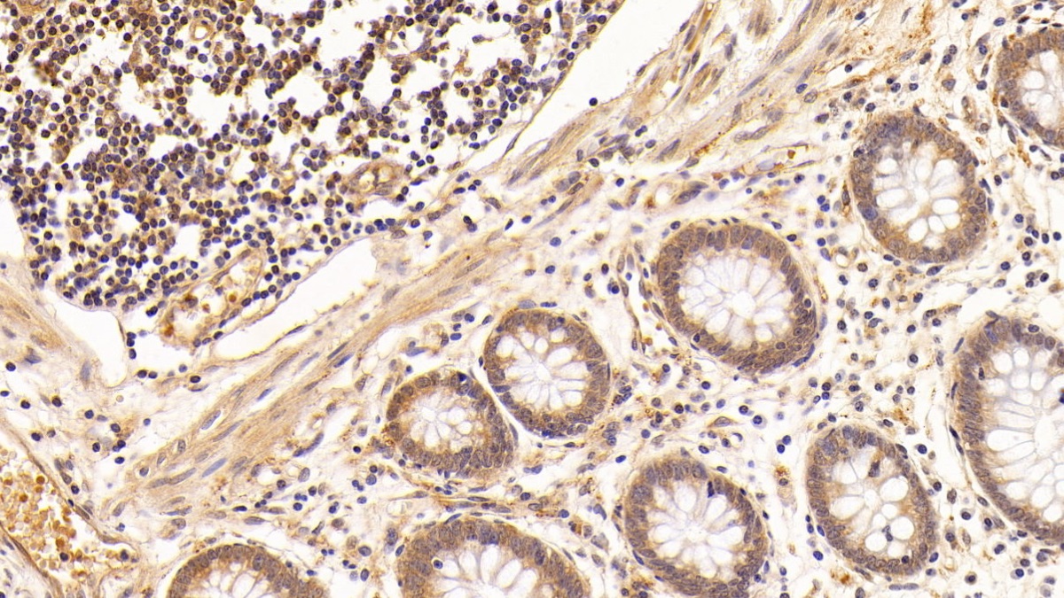 Monoclonal Antibody to Vascular Endothelial Growth Factor C (VEGFC)