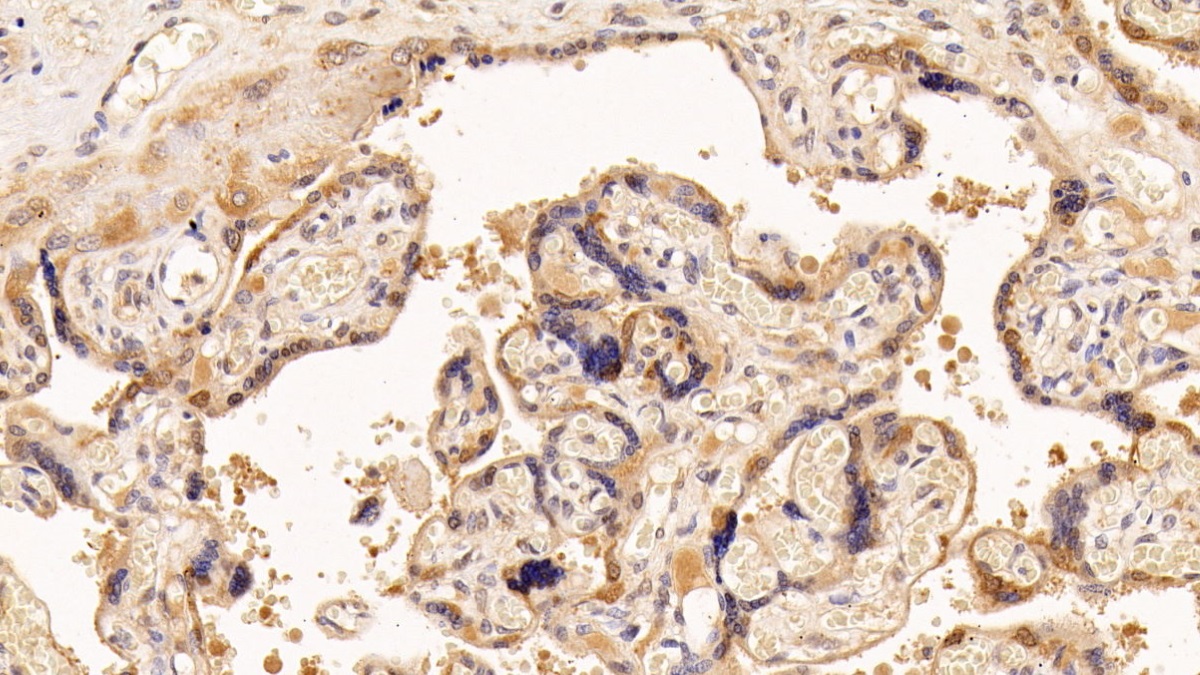 Monoclonal Antibody to Vascular Endothelial Growth Factor C (VEGFC)