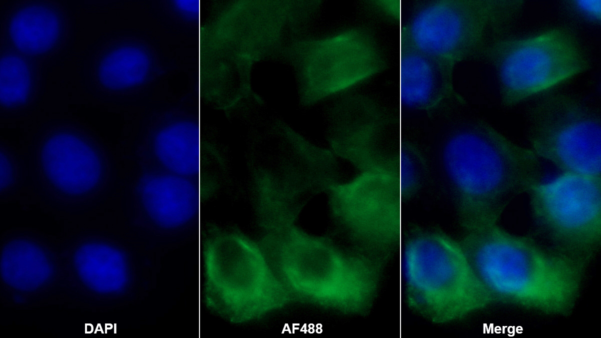 Monoclonal Antibody to Vascular Endothelial Growth Factor C (VEGFC)