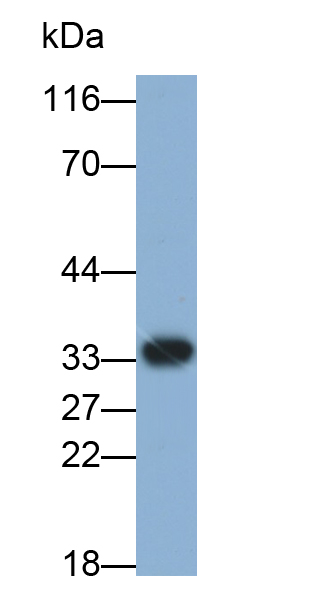 Monoclonal Antibody to Prostate Specific Antigen (PSA)
