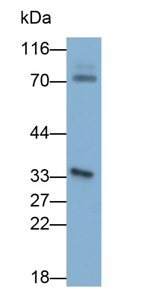 Monoclonal Antibody to Prostate Specific Antigen (PSA)