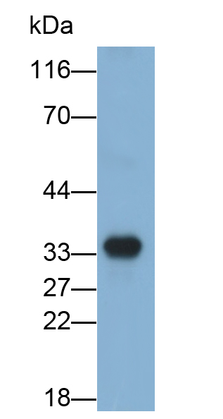 Monoclonal Antibody to Prostate Specific Antigen (PSA)
