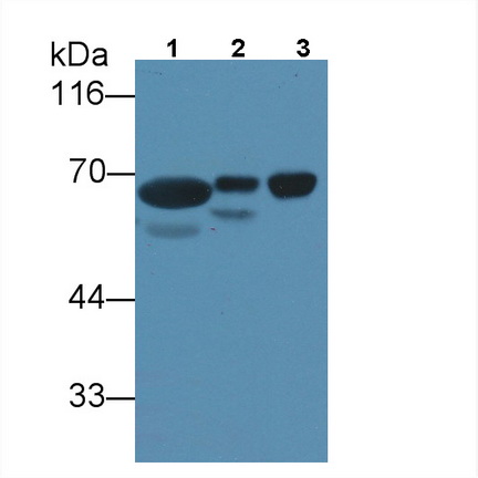 Monoclonal Antibody to Alpha-Fetoprotein (AFP)