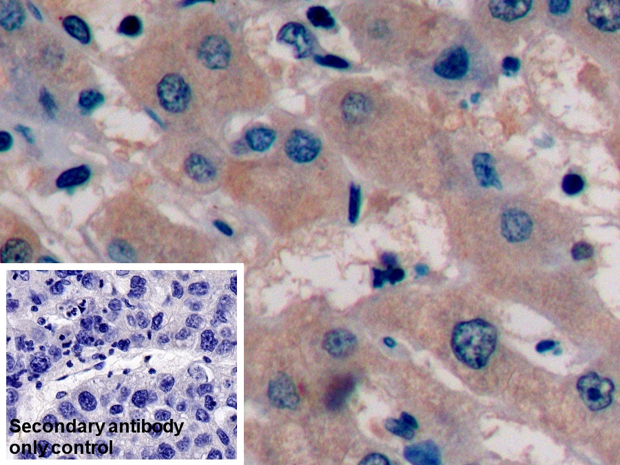 Monoclonal Antibody to Alpha-Fetoprotein (AFP)