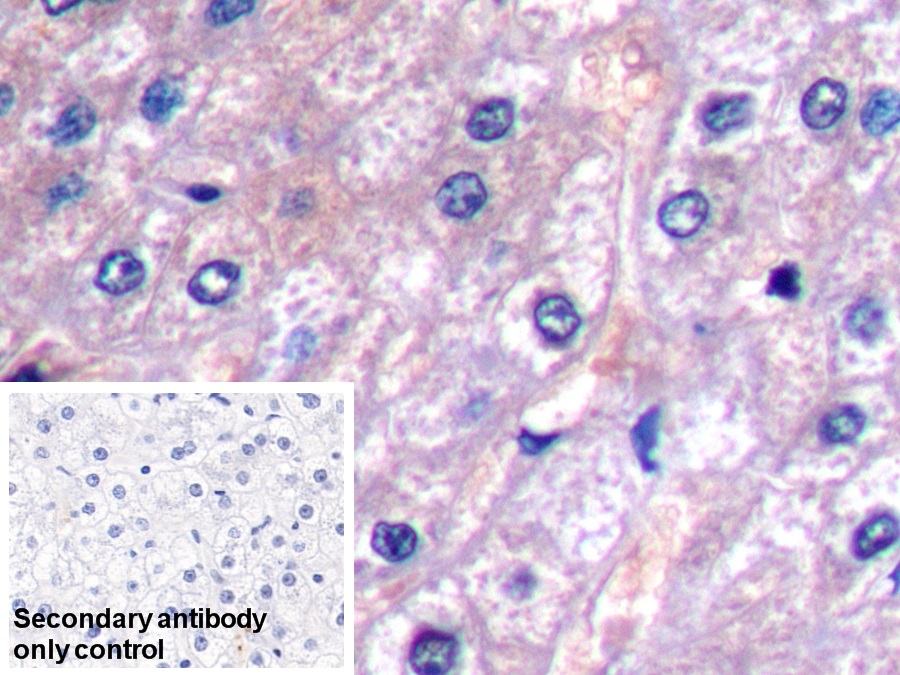 Monoclonal Antibody to Alpha-Fetoprotein (AFP)