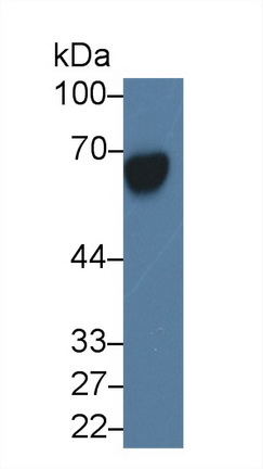 Monoclonal Antibody to Alpha-Fetoprotein (AFP)