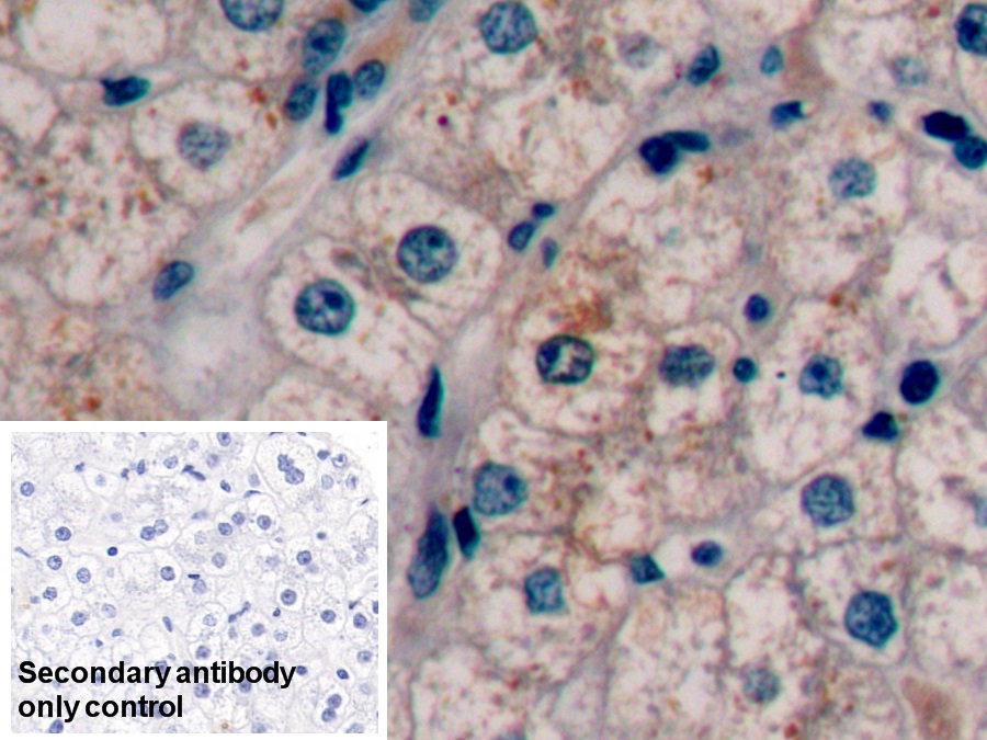 Monoclonal Antibody to Alpha-Fetoprotein (AFP)