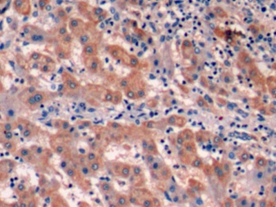 Monoclonal Antibody to Alpha-Fetoprotein (AFP)