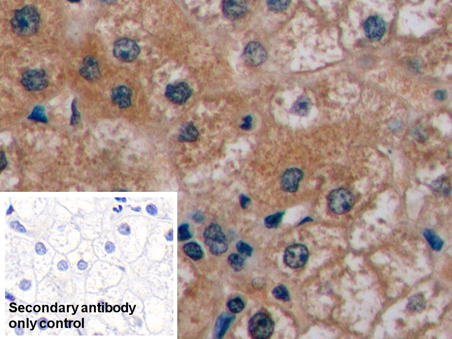 Monoclonal Antibody to Alpha-Fetoprotein (AFP)