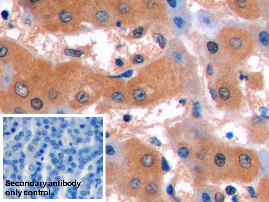 Monoclonal Antibody to Alpha-Fetoprotein (AFP)